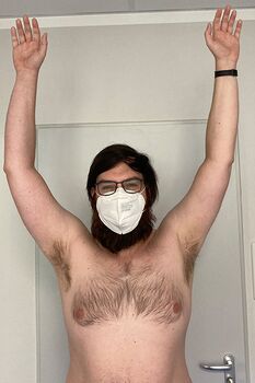 Bild postoperativ Schulterinstabilität Dorsal Knöchern Ergebnis