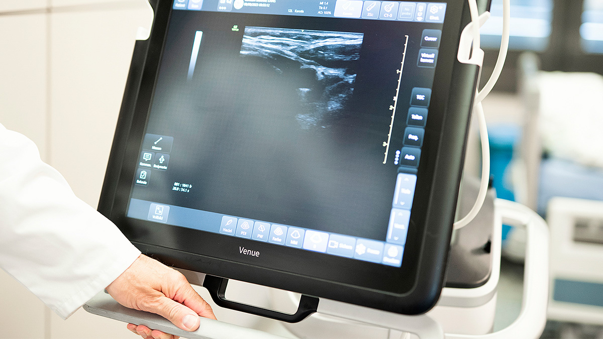 Bild vom Ultraschall Bildschirm