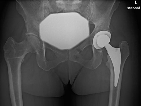 Bild postoperatives Röntgen