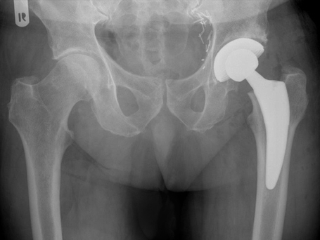 Bild nach TEP Piater