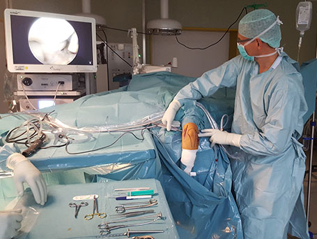 Bild OP Arthroskopie Ellenbogen