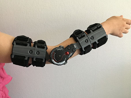 Bild Ellenbogengelenksorthese