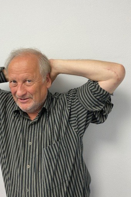 Bild Ellenbogenluxation nach OP verschränkt die Arme hinter dem Kopf