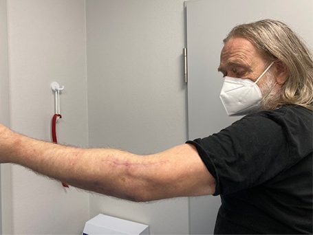 Bild Patient streckt den Arm von sich