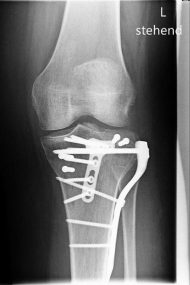 Bild nach Rekonstruktion