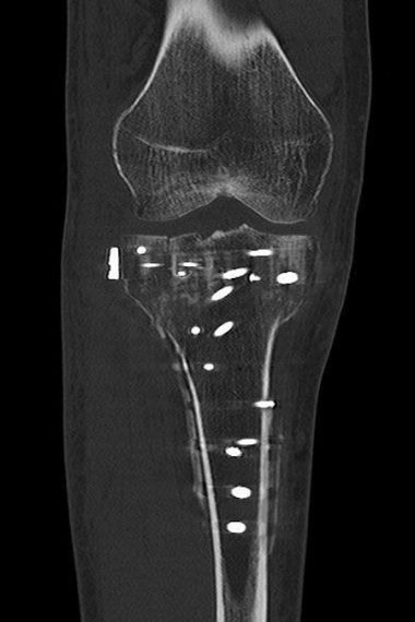 Bild Röntgenaufnahme