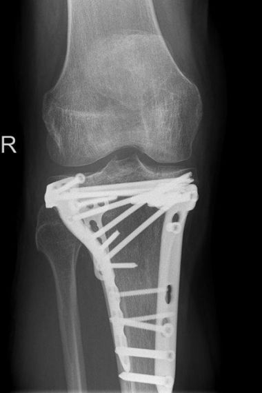 Bild Röntgenaufnahme