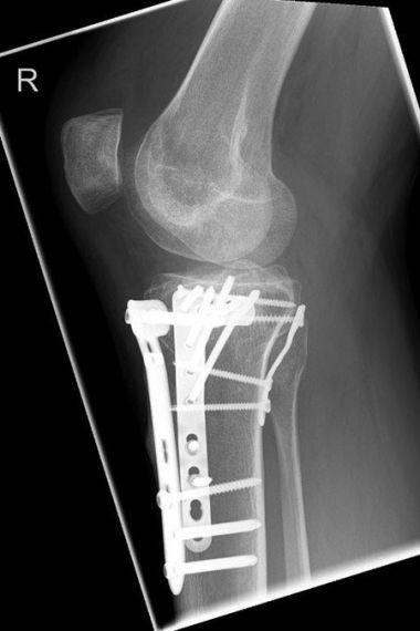 Bild Röntgenaufnahme