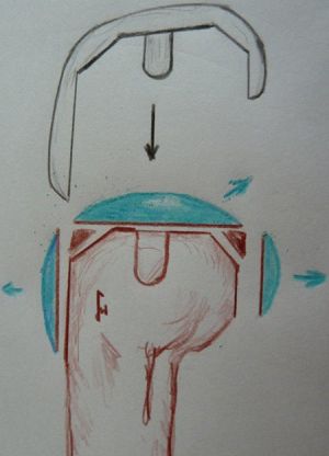 Bild Knie TEP Zeichnung Femur