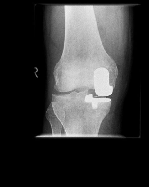 Bild Oxfordschlitten von Vorn