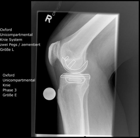 Bild Planungsaufnahme Oxfordschlitten
