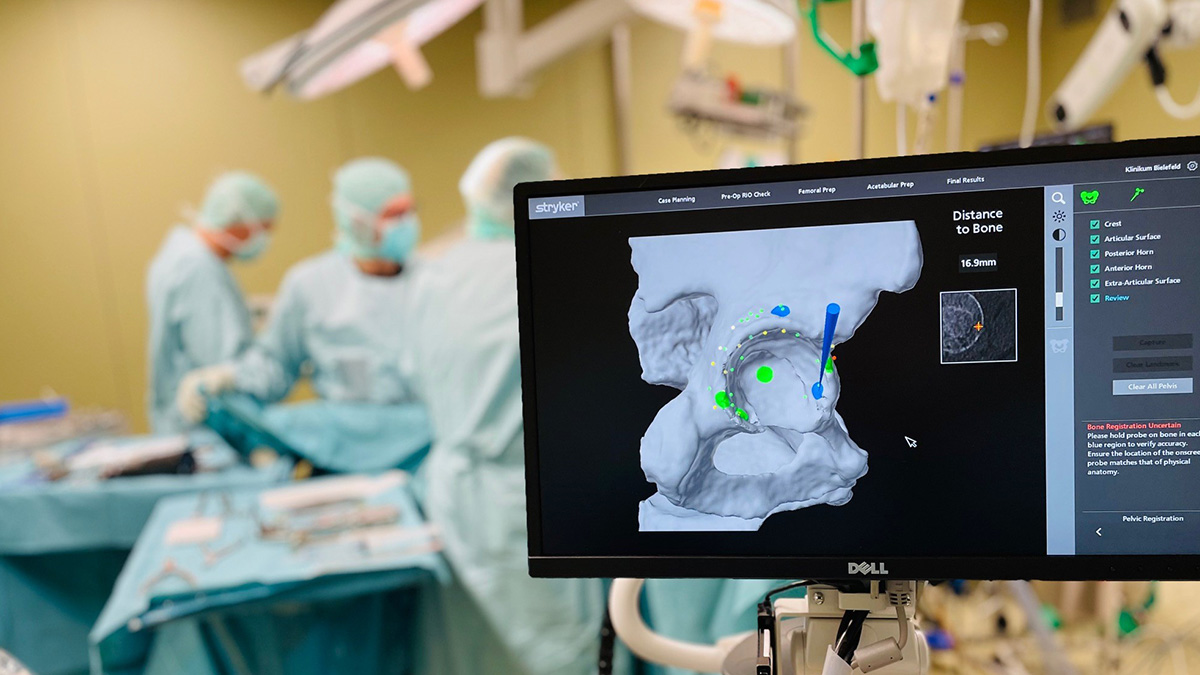 Bild 1000ste Operation mit dem Mako Robotersystem