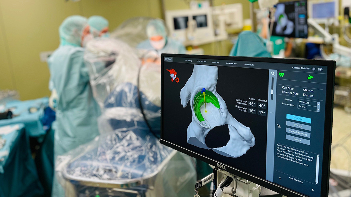 Bild 1000ste Operation mit dem Mako Robotersystem